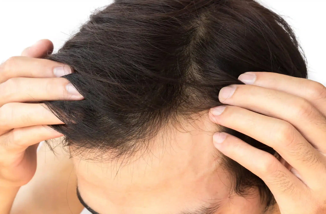 What to Do After Hair Growth Treatment in Singapore