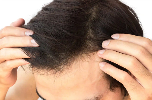 What to Do After Hair Growth Treatment in Singapore