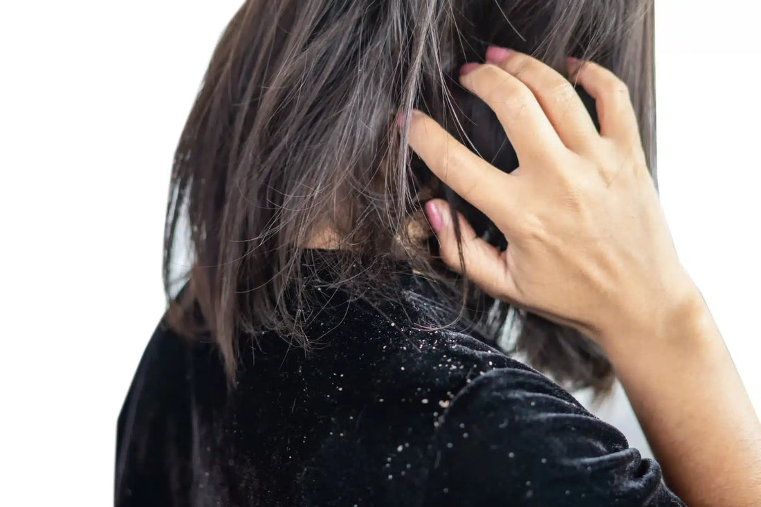How Air Conditioning Worsens Dry Scalp in Singapore