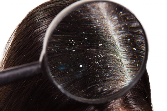 Which Dandruff Treatment Is The Most Effective? | TrichoLab