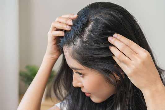 Is Your Scalp Crying for Help? Try a Detox Mask (2025)