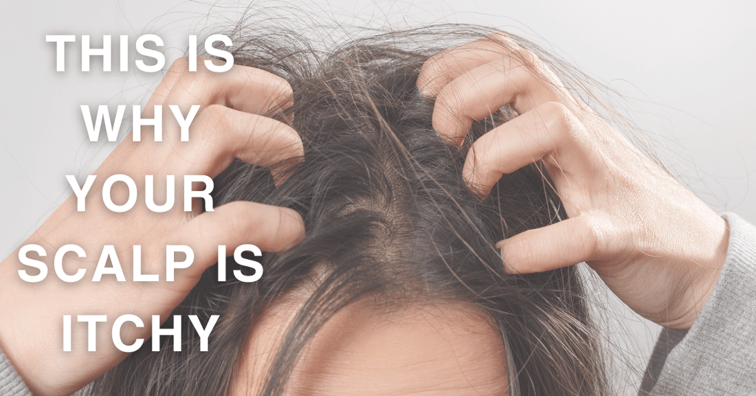 Why you should not ignore an itchy scalp