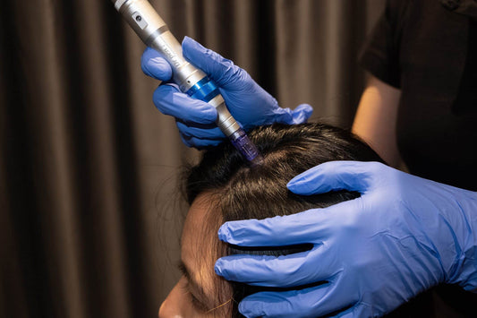 Guide to Microneedling for Hair loss: How to Make it Work - TrichoLab