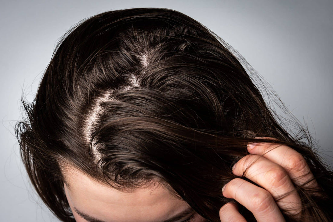 How To Know If You Have An Oily Scalp And How To Treat It - TrichoLab