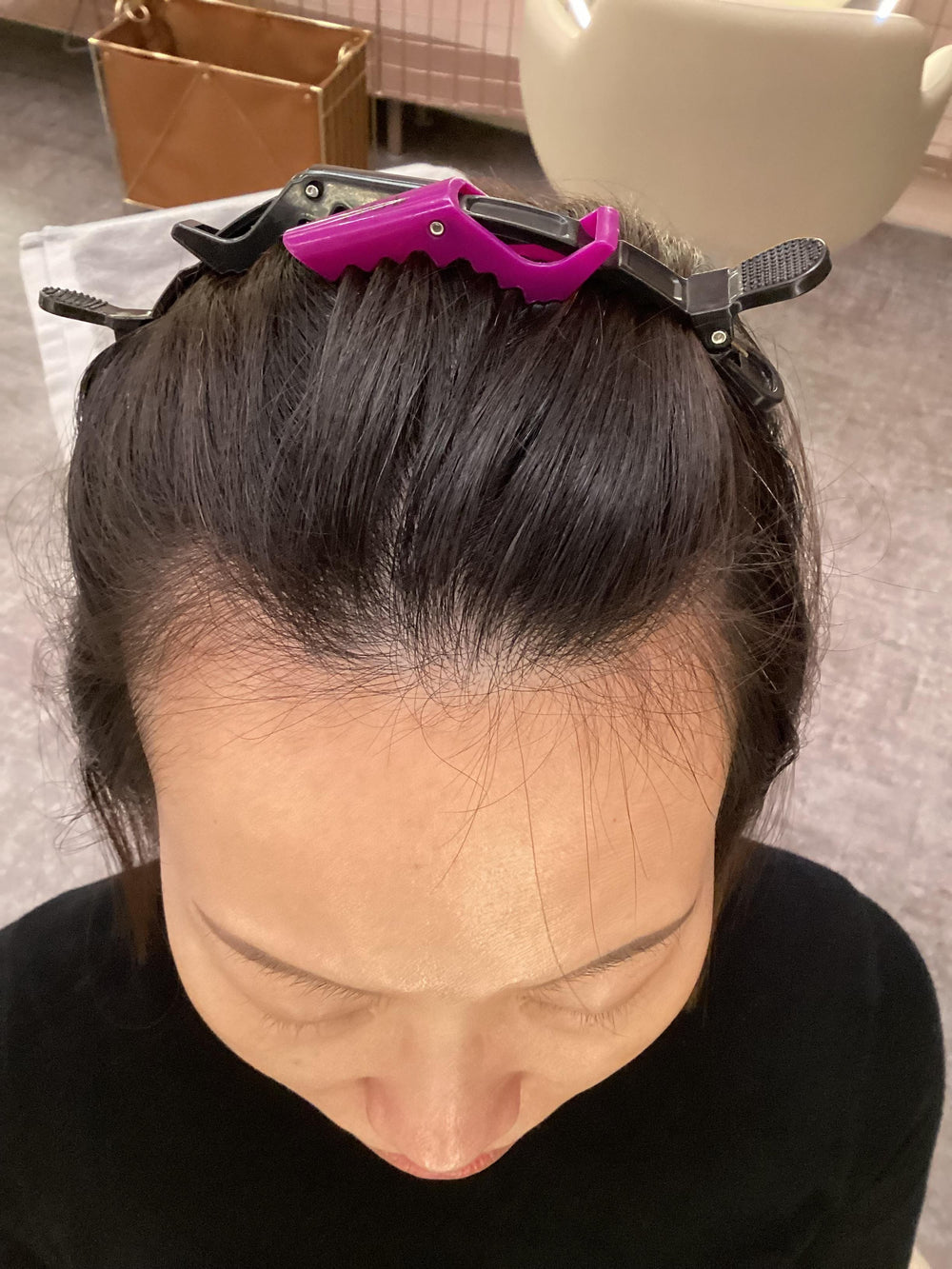 Sample after photo of a client's scalp