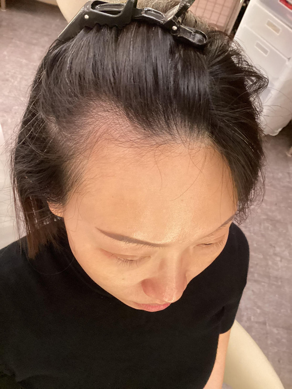 Sample before photo of a client's scalp